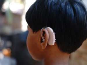 Young Girl with Profound Hearing Loss and her new hearing aid