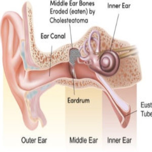 8 hour ear operation