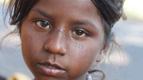 Some Scars are visible, others aren't : living the Slum Life