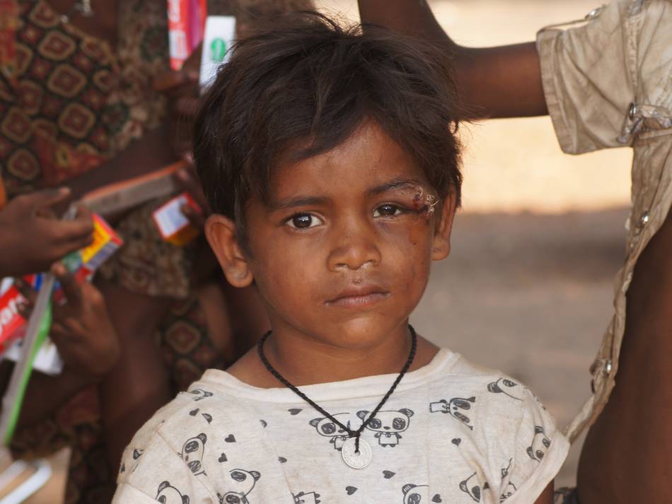 Young Street Child With Wound