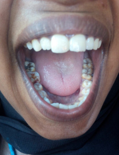 A Trip To The Dentist