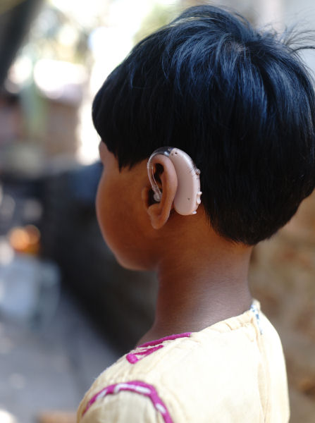 Young Girl with Profound Hearing Loss and her new hearing aid