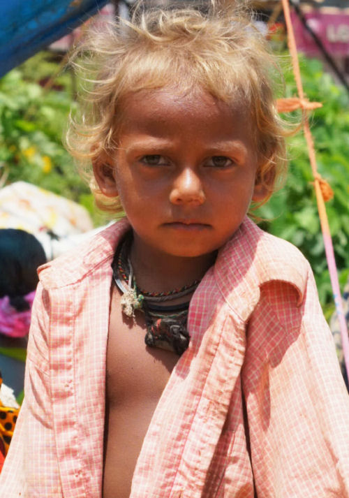 Boy had malnutrition and TB (Picture for illustration only)