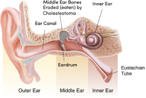 8 hour ear operation