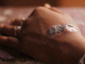 Local Tattoos react leaving an infected area on her hand